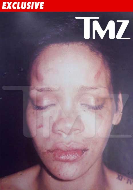 Pictures Of Rihanna Beat Up. RIHANNA BEAT UP PIC damn…